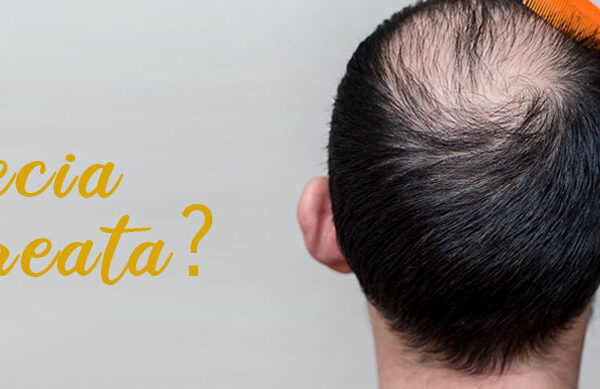 O que é a Alopecia Areata?